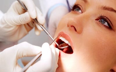 How Long Does a Tooth Filling Last? Key Insights