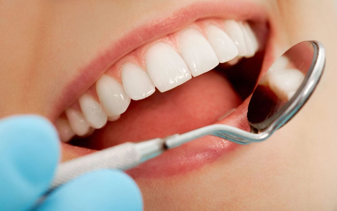 Types of Fillings and Their Benefits Explained